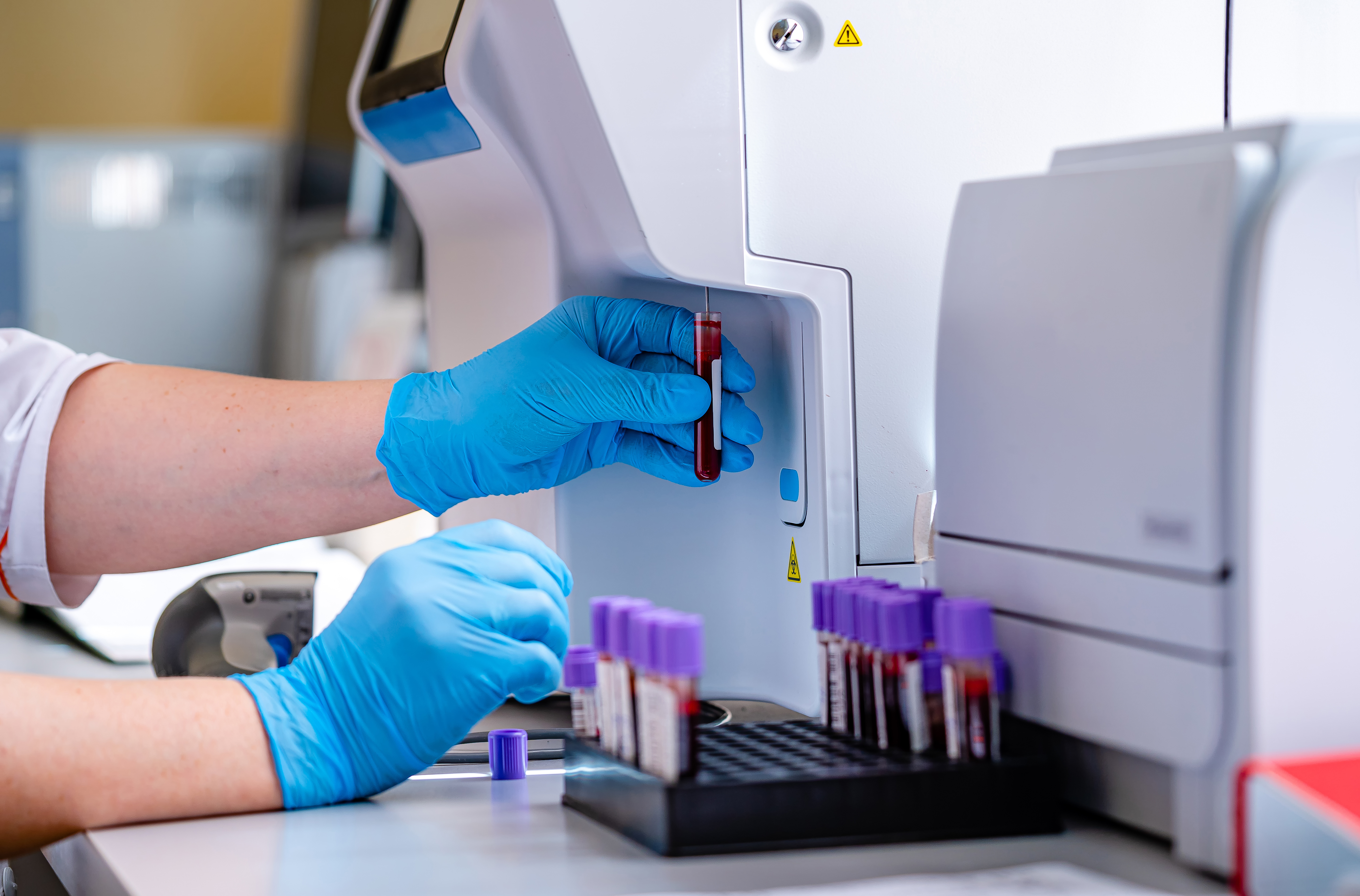 New analytical method enhances tracking of persistent organic pollutants in human blood
