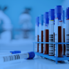 Mixture risk assessment using HBM data