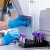 New analytical method enhances tracking of persistent organic pollutants in human blood